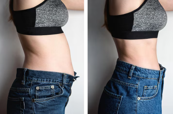 Antes e depois de Patrícia L.