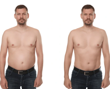 Antes e depois de Carlos M.