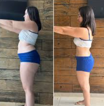 Antes e depois de Mariana S.